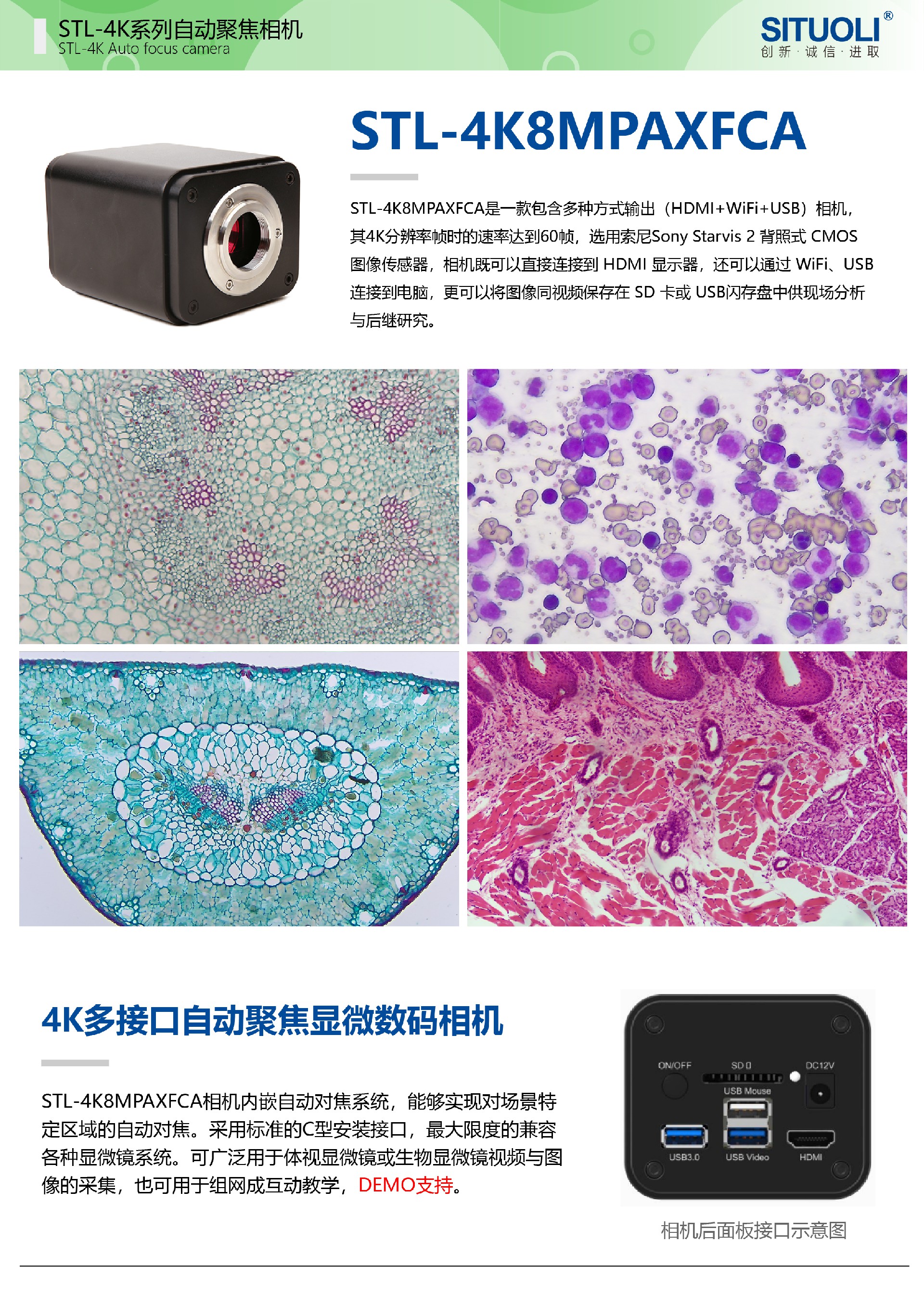 STL-4K8MPAXFCA-01.jpg